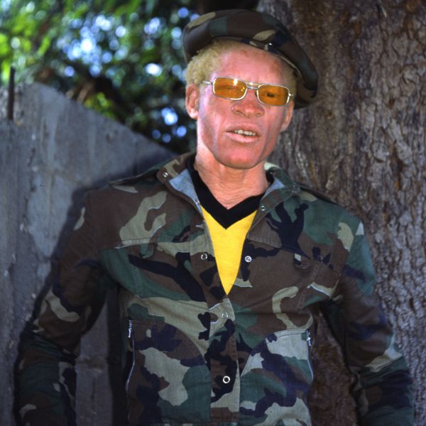 Datei:Yellowman.jpg
